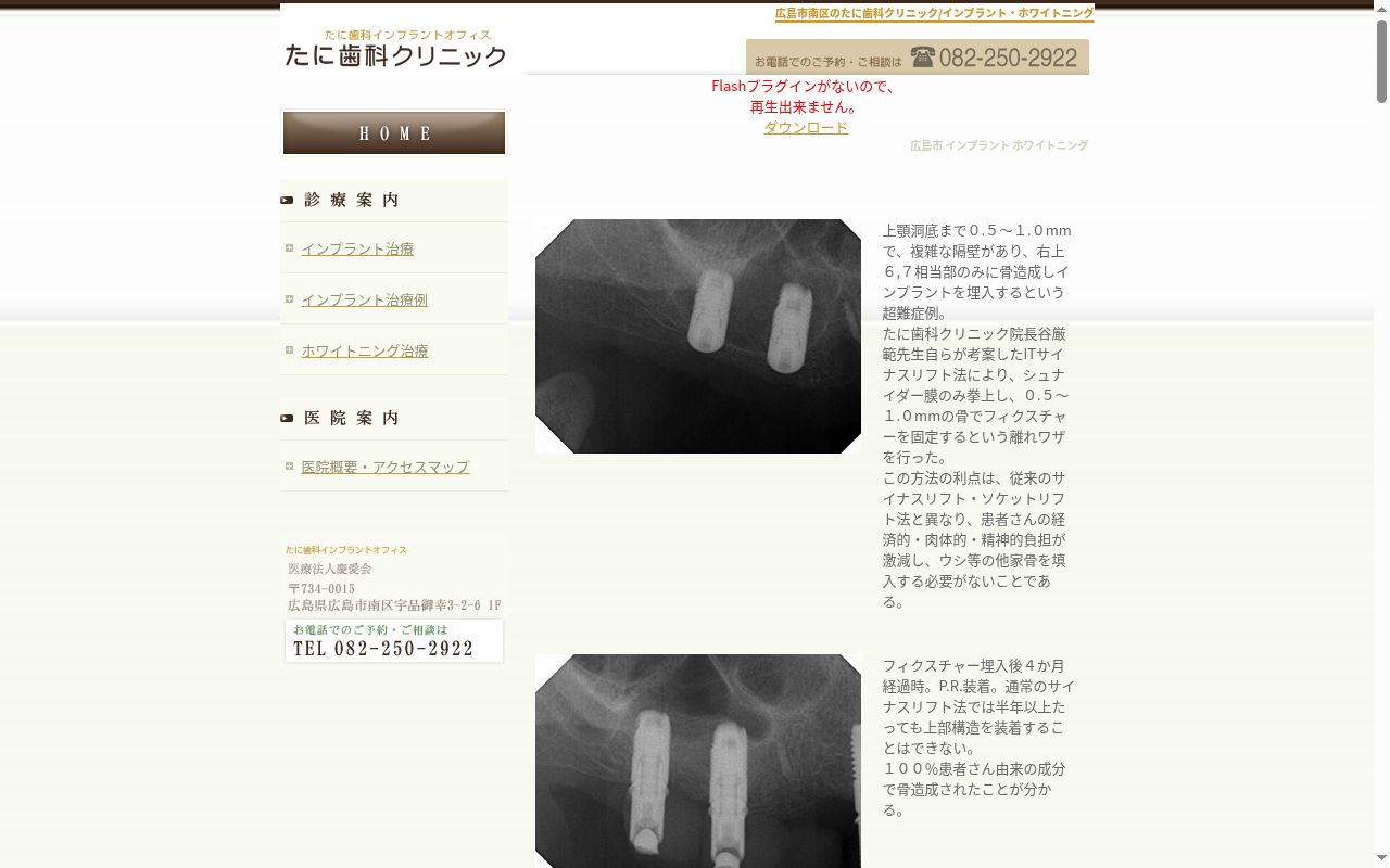 医療法人慶愛会たに歯科クリニックの公式サイトのスクリーンショット