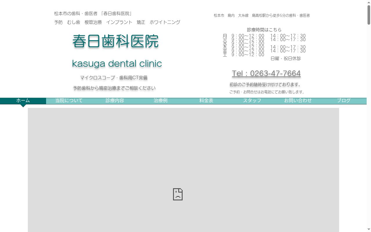 春日歯科医院の公式サイトのスクリーンショット