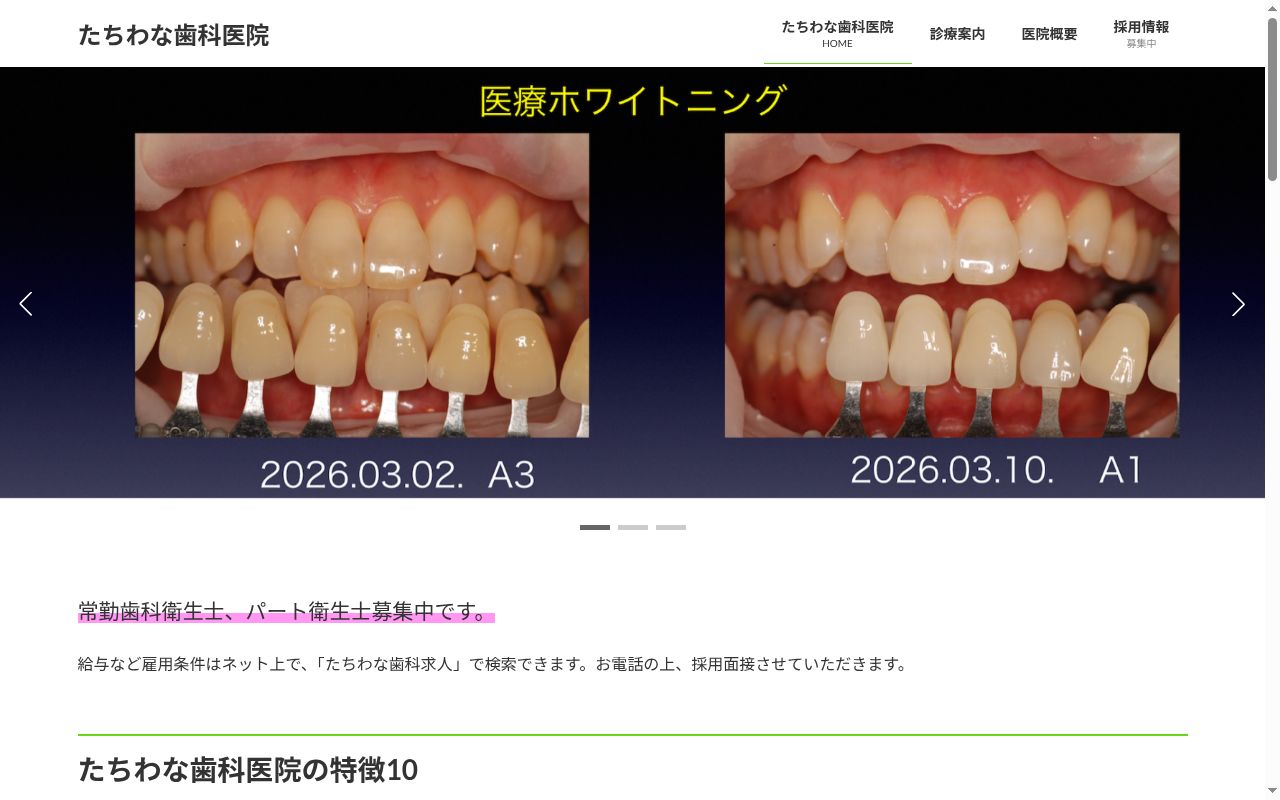 たちわな歯科医院の公式サイトのスクリーンショット