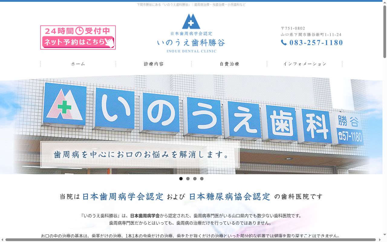 いのうえ歯科勝谷の公式サイトのスクリーンショット